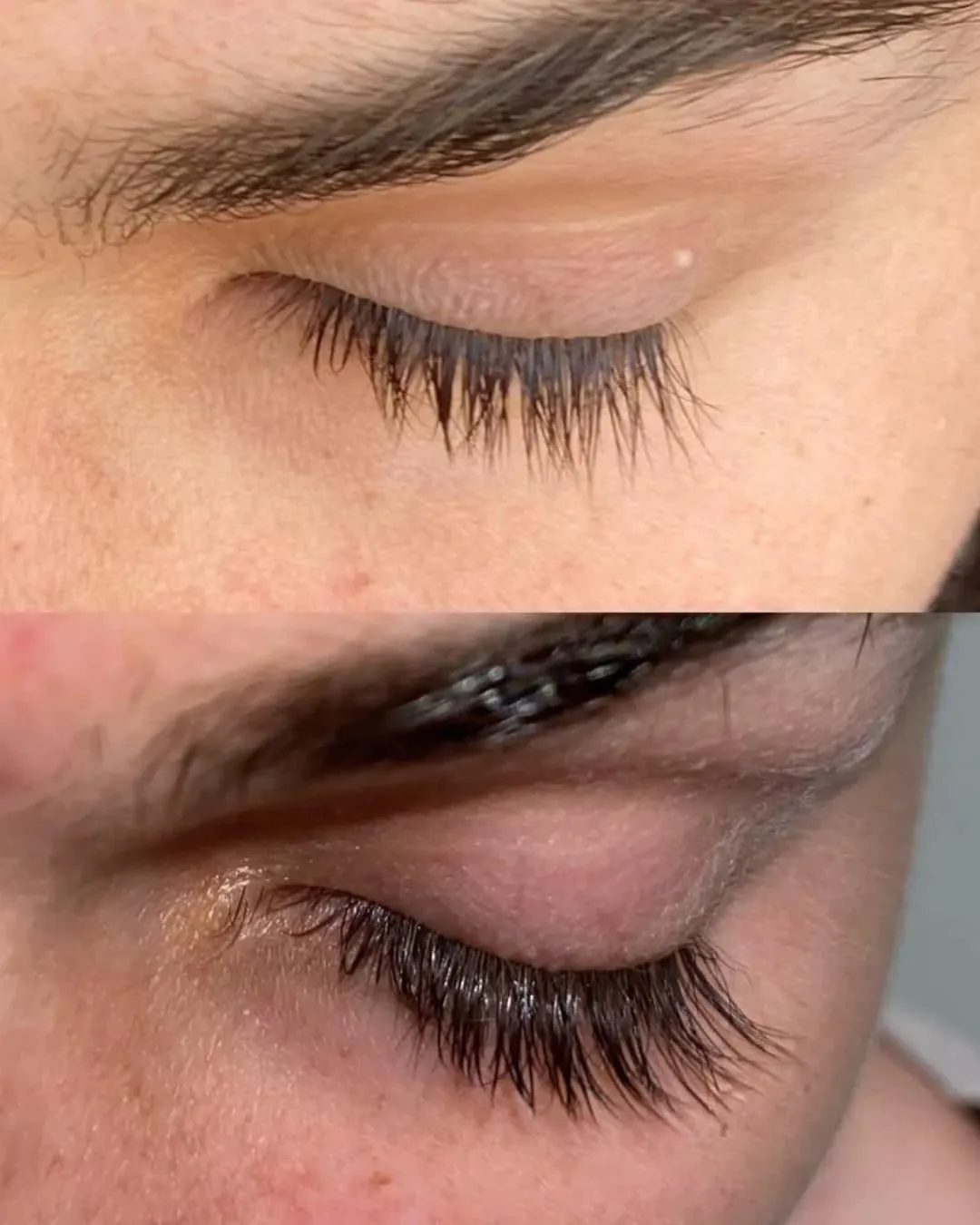 Lenoites® Eyelash Activating Serum 5 ml