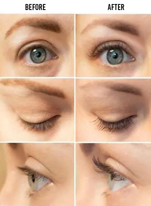 Lenoites® Eyelash Activating Serum 5 ml